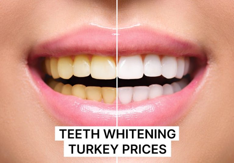 Teeth Whitening Turkey Prices Pros and More